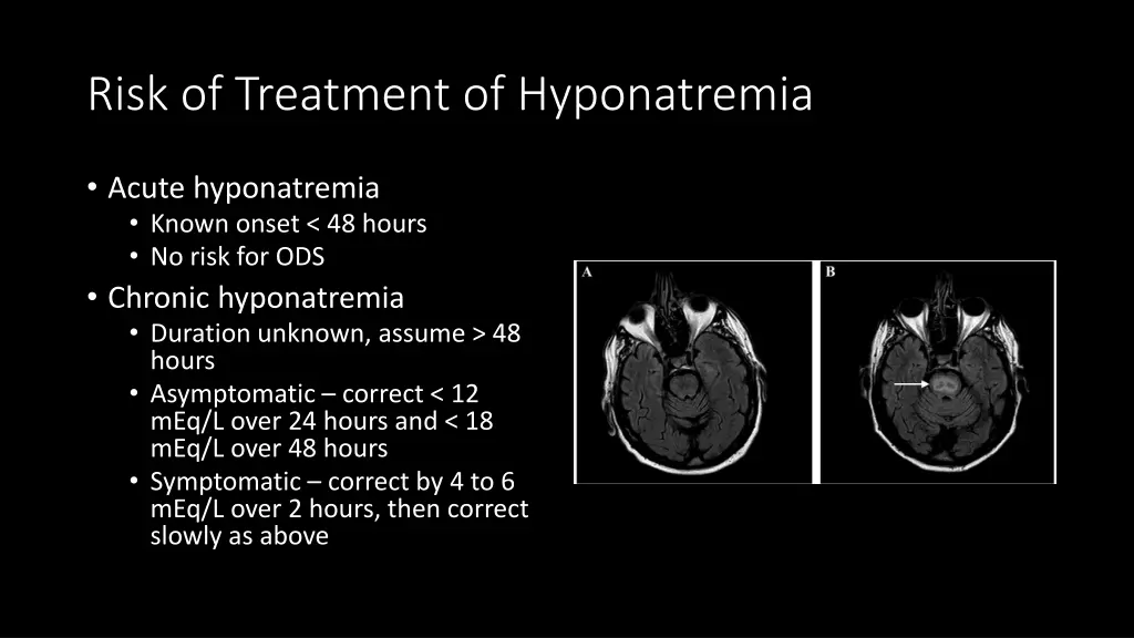 risk of treatment of hyponatremia 1