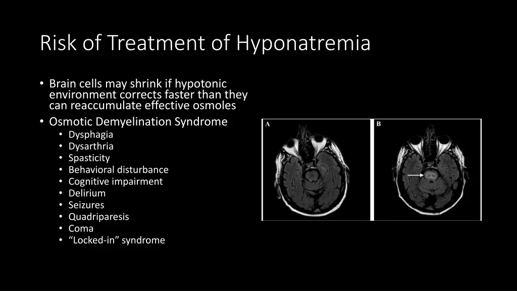 risk of treatment of hyponatremia