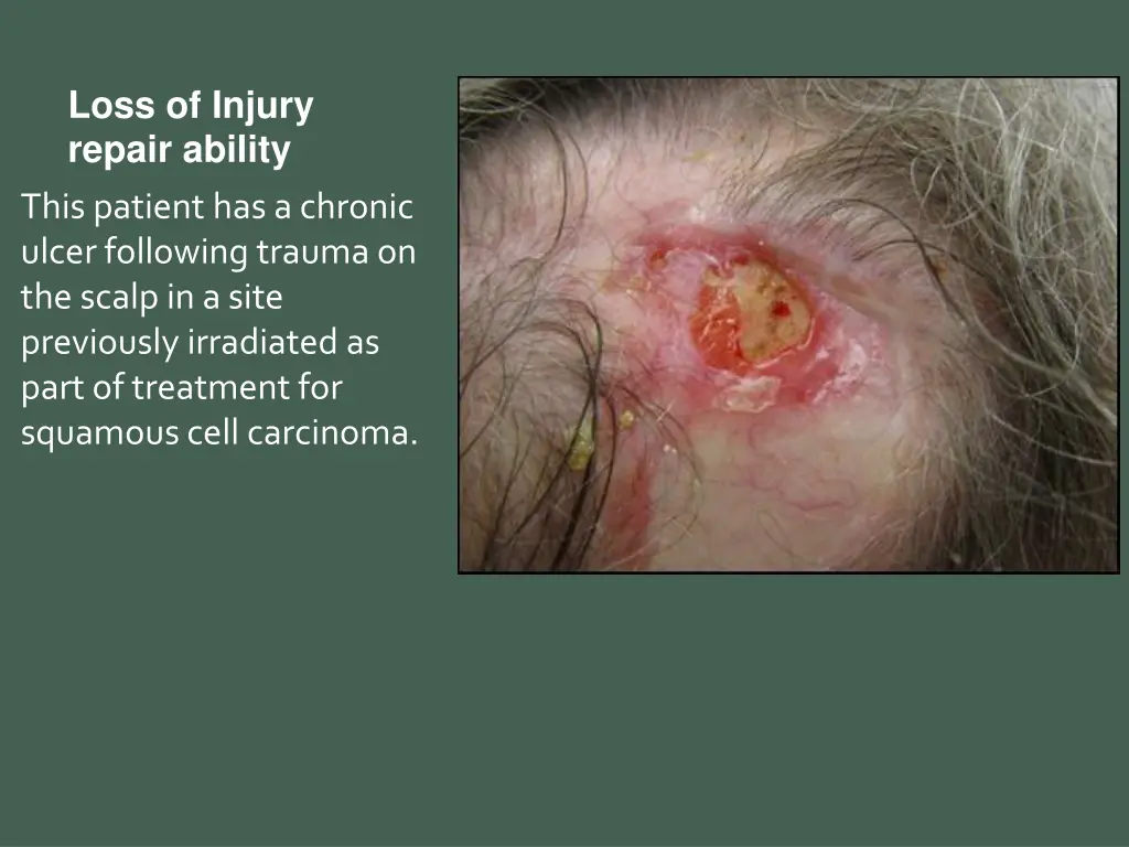 loss of injury repair ability