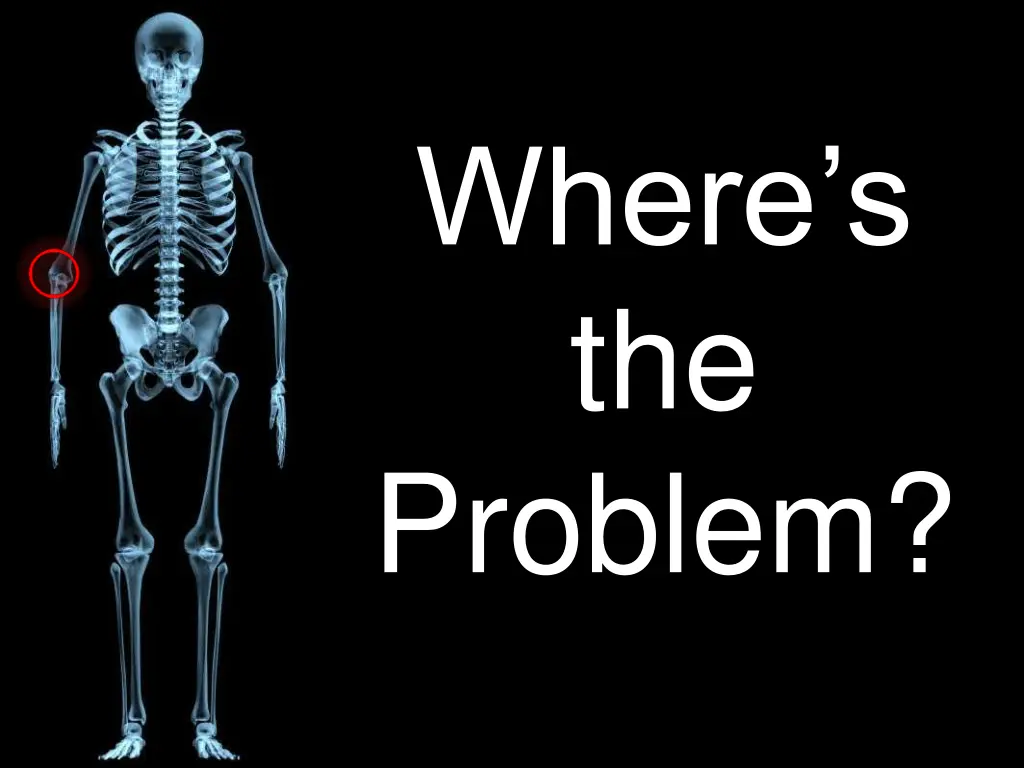 where s the problem