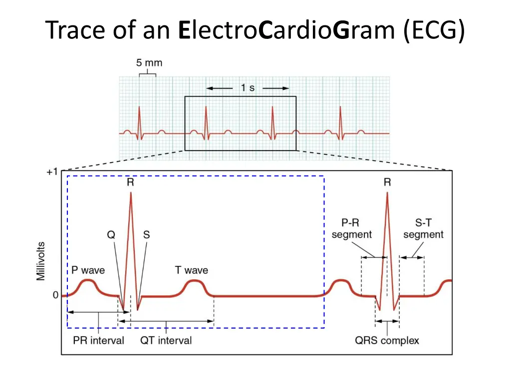trace of an e lectro c ardio g ram ecg