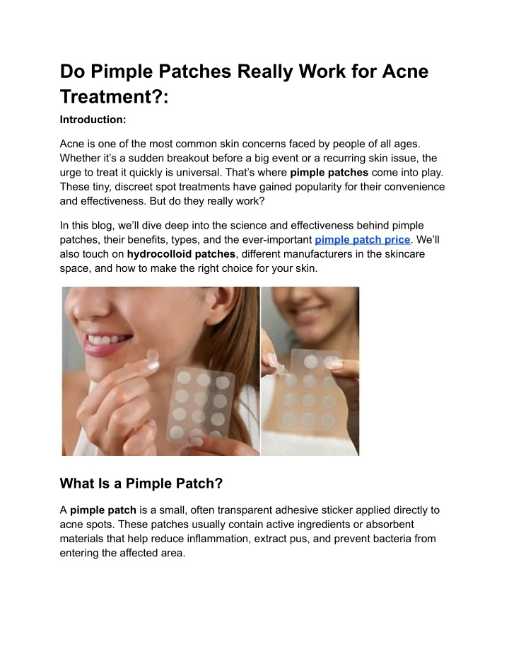 do pimple patches really work for acne treatment