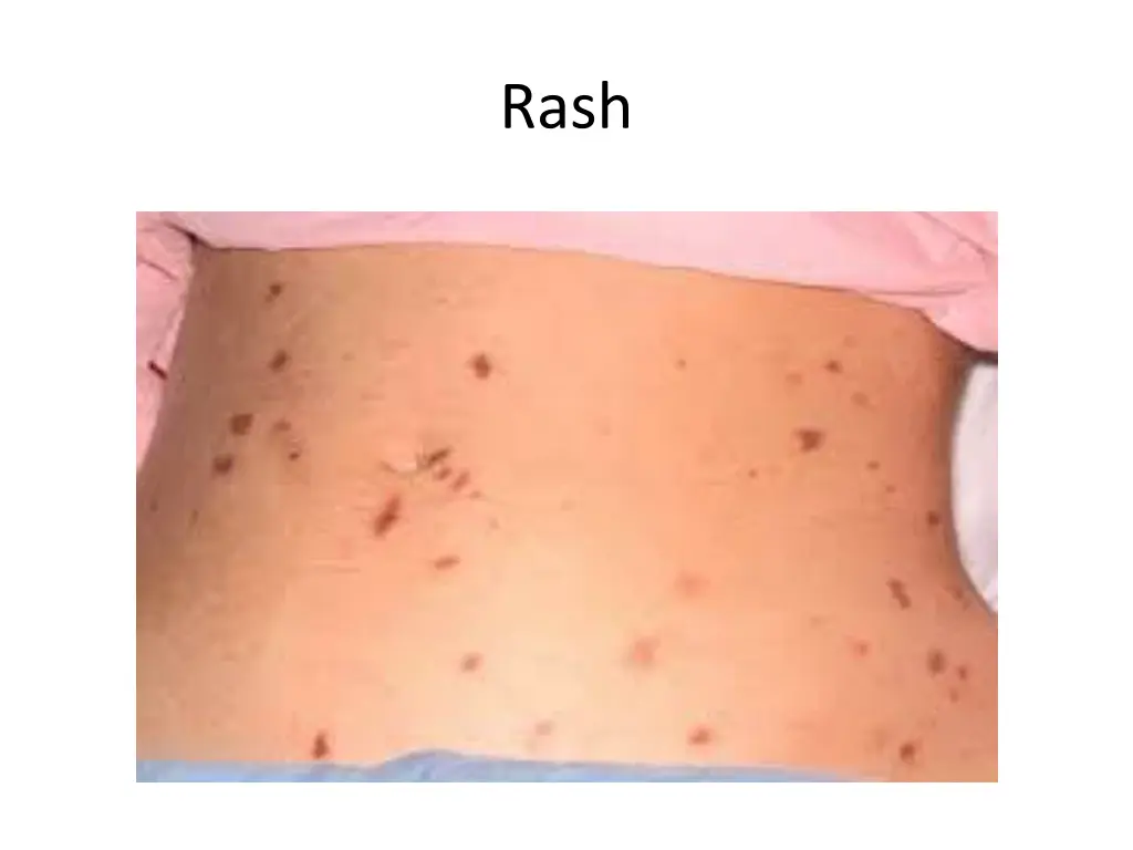 slide27