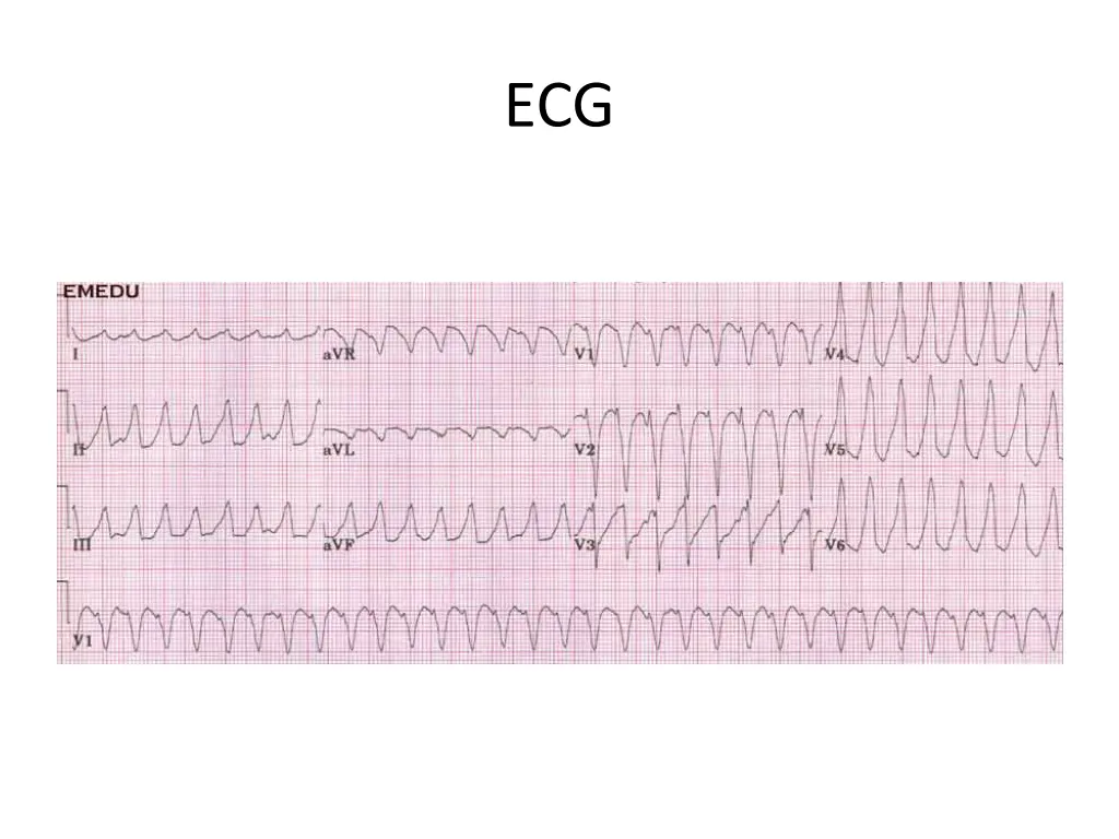 slide35