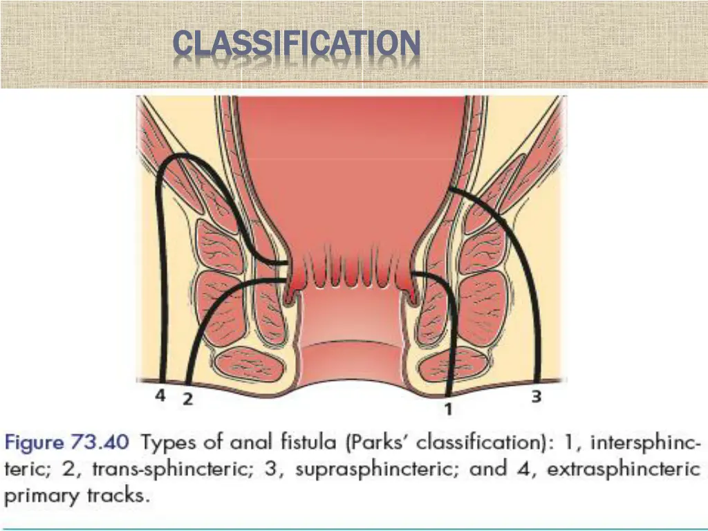 classification classification