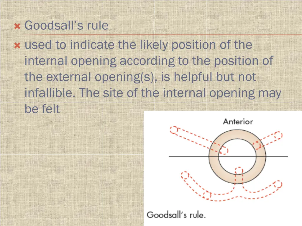 goodsall s rule used to indicate the likely