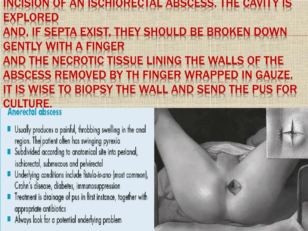 incision of an ischiorectal abscess the cavity