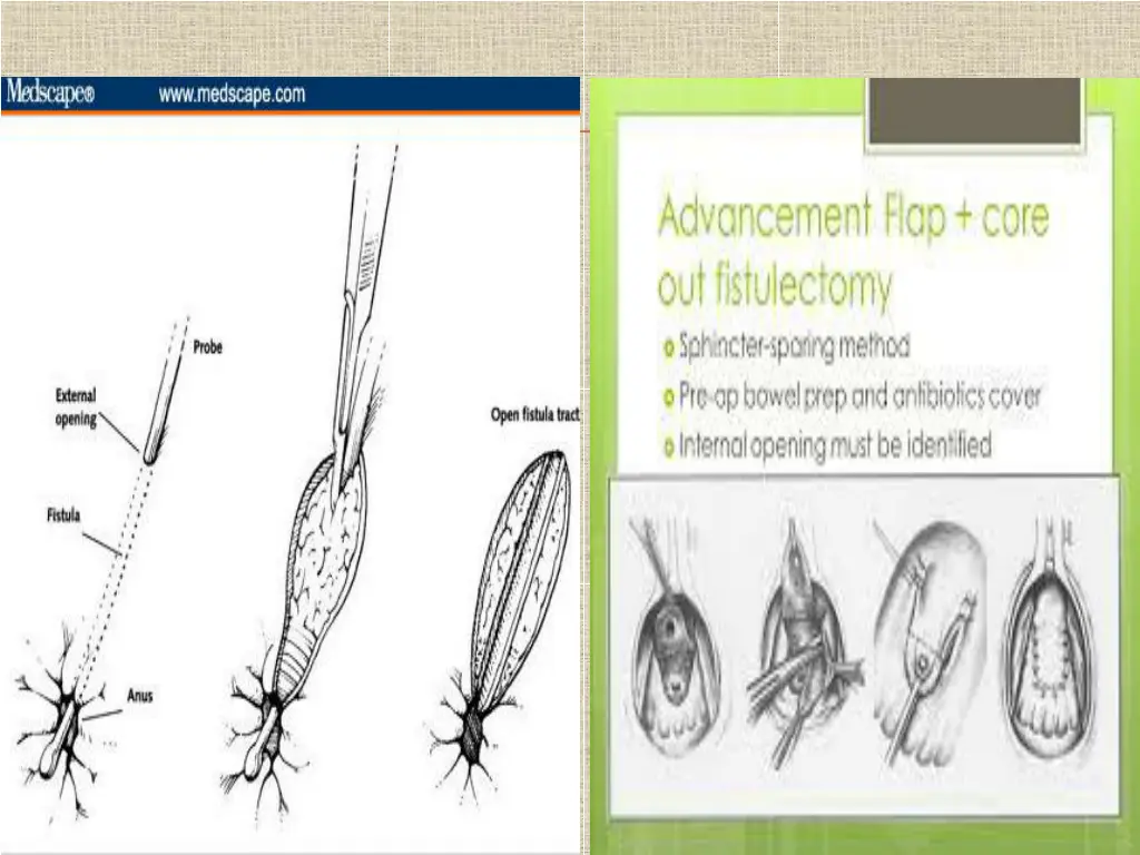 slide17