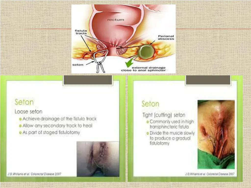 slide18