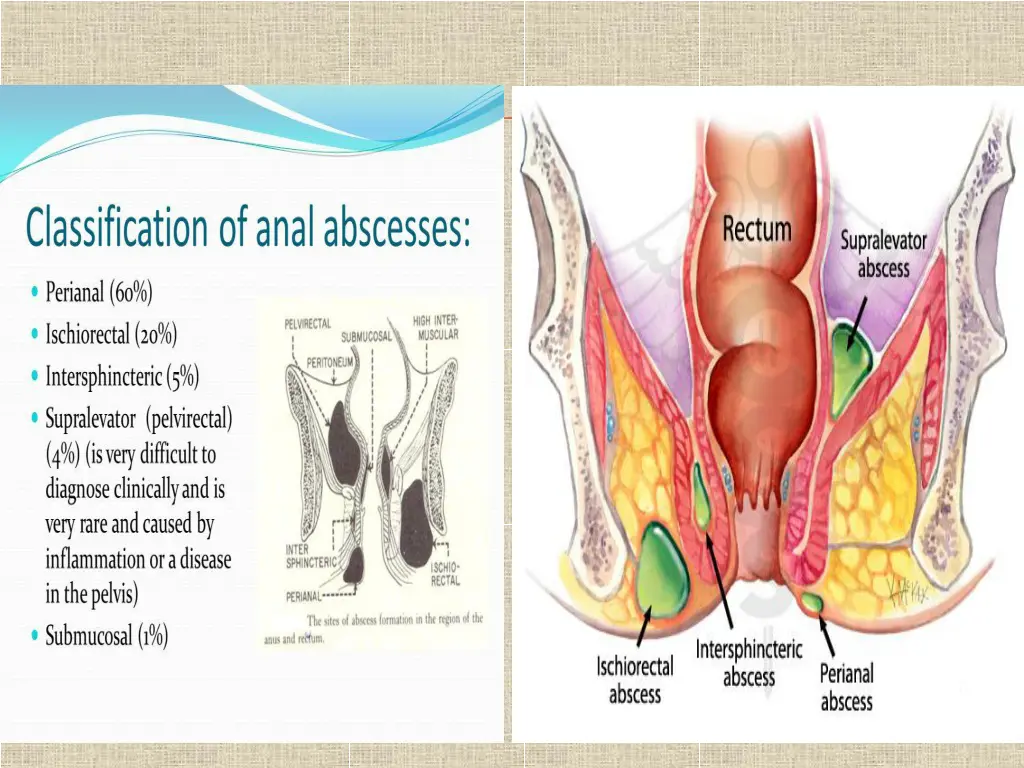 slide6