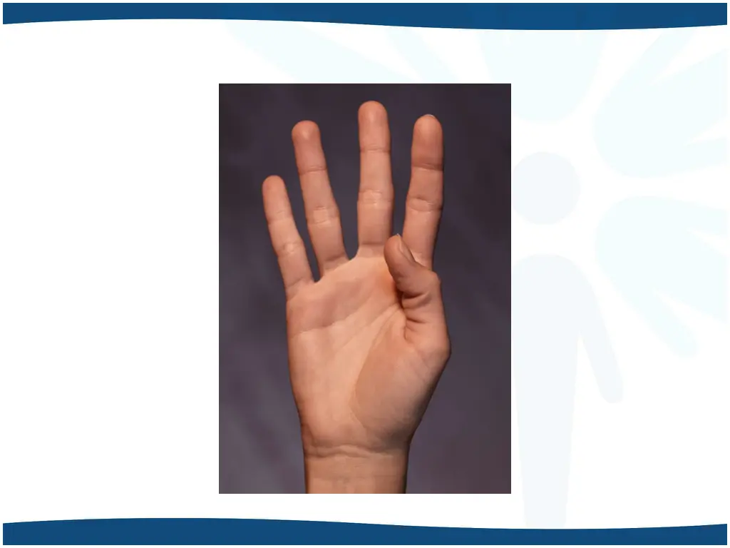 slide17