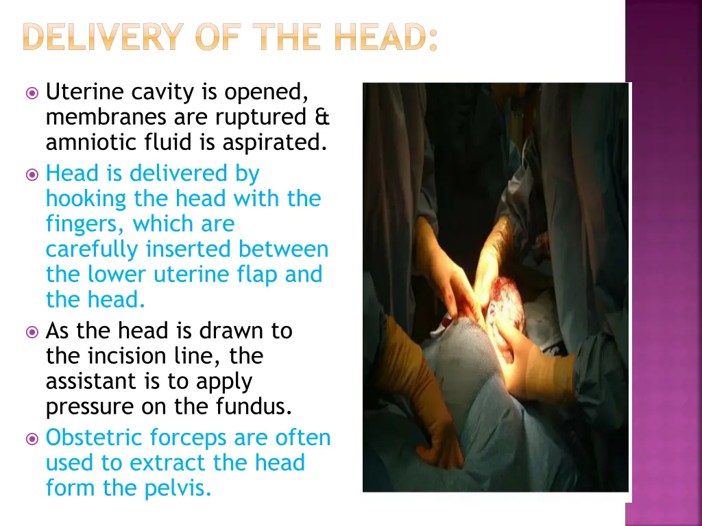 delivery of the head