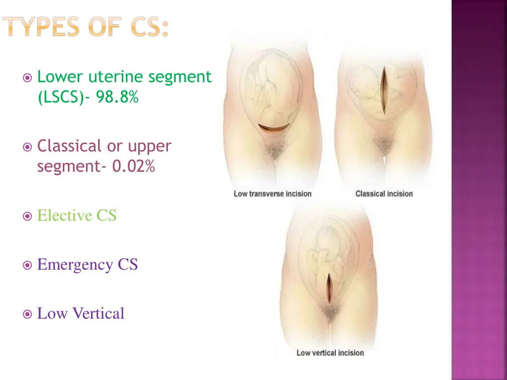 types of cs