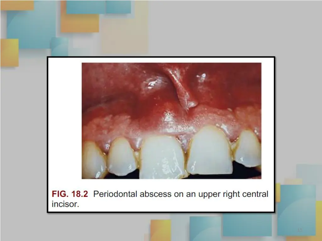 slide15