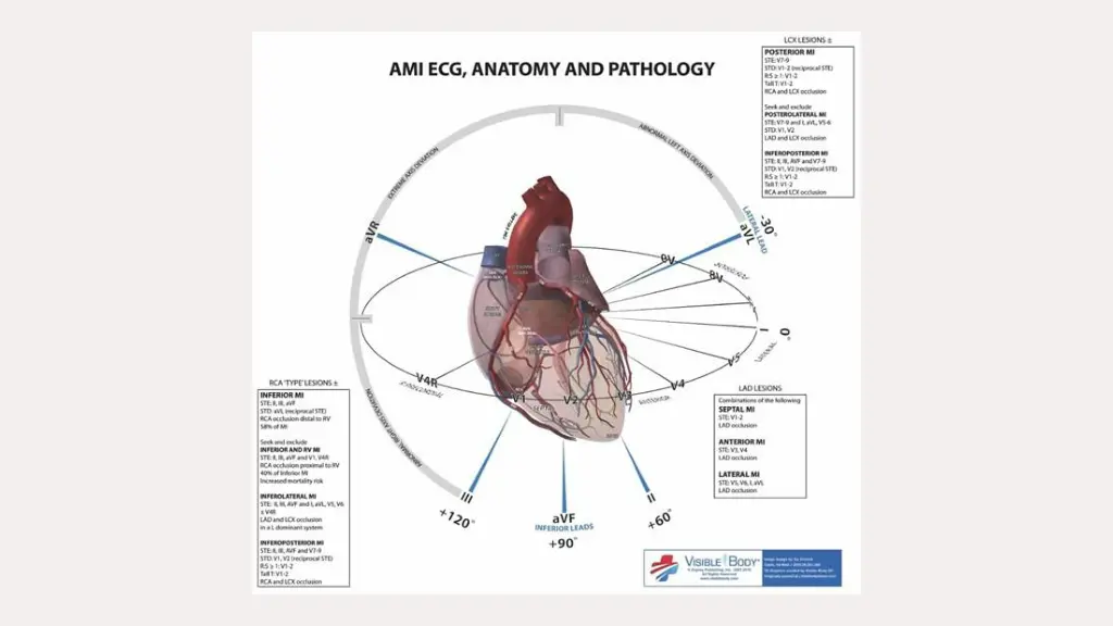 slide7
