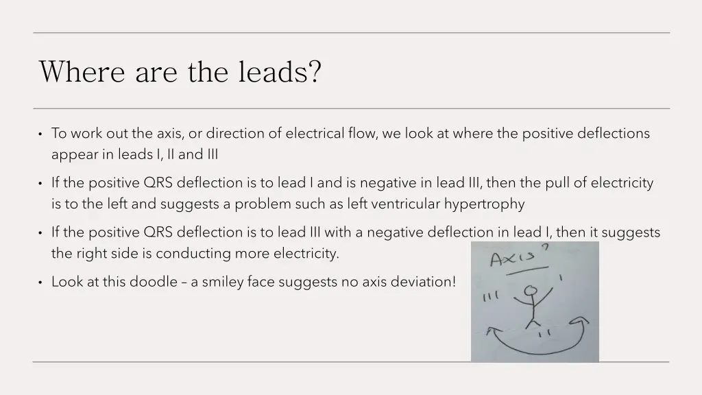 where are the leads 1