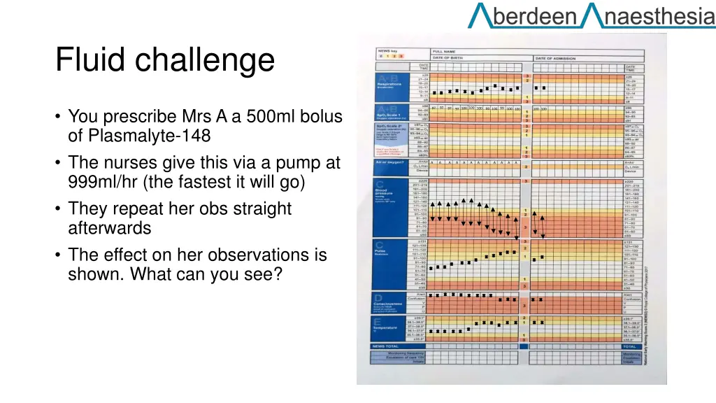 fluid challenge