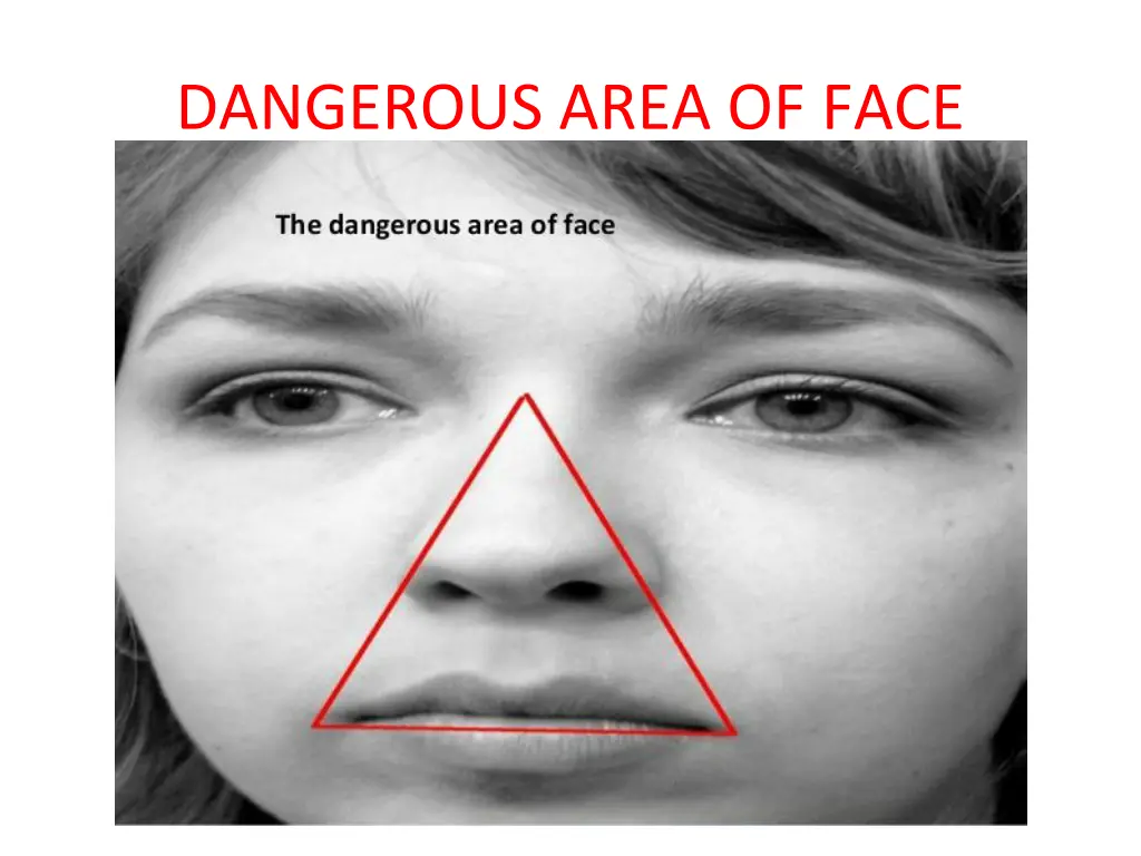 dangerous area of face