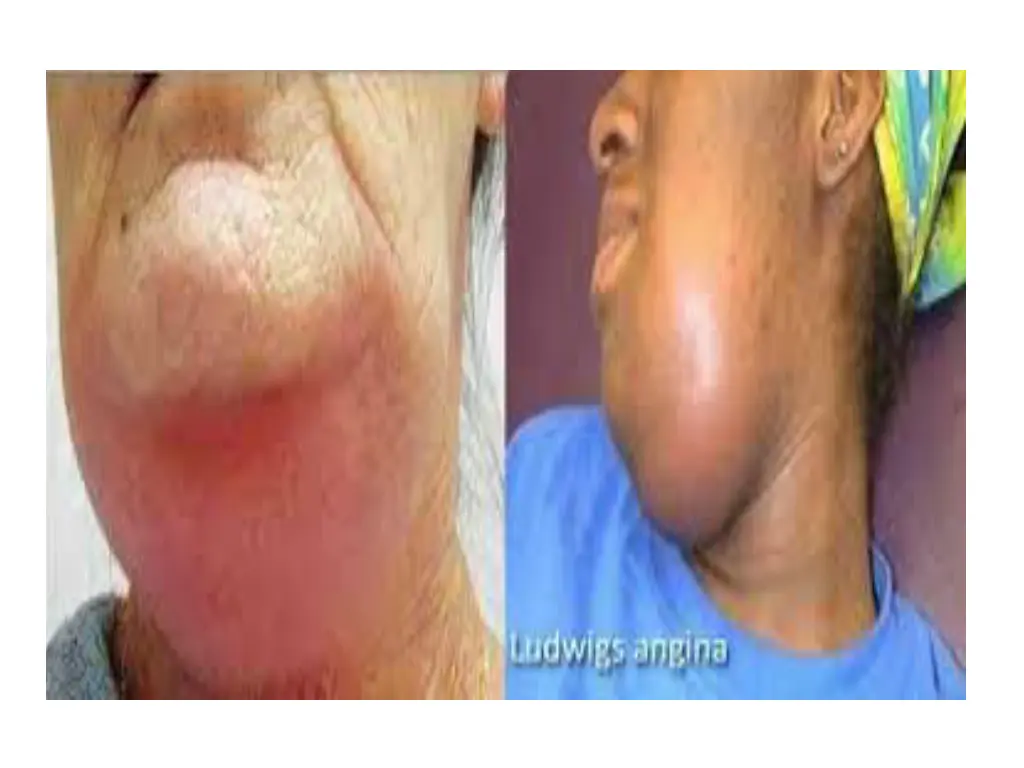 slide16
