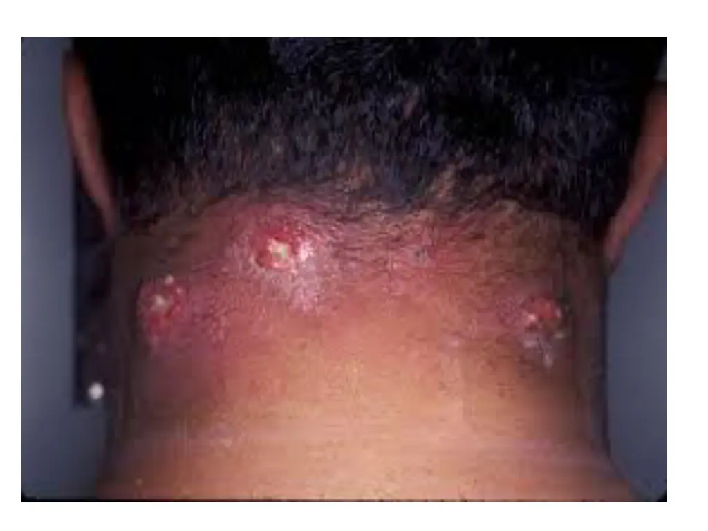 slide27