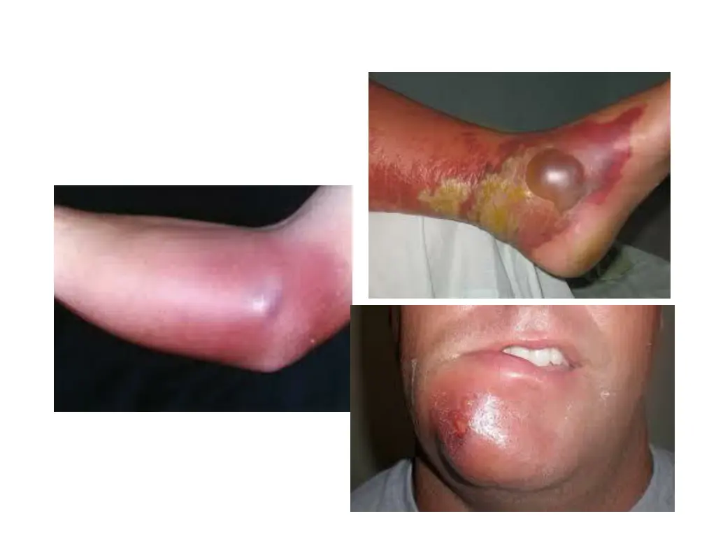 slide5