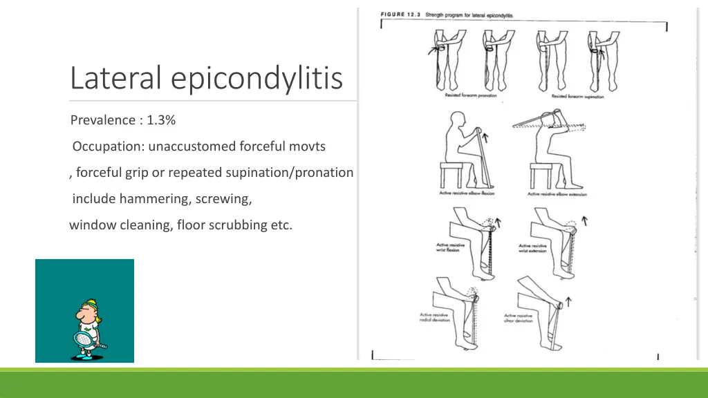 lateral epicondylitis