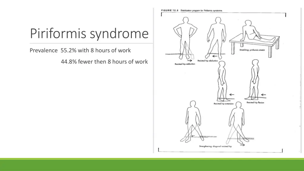 piriformis syndrome
