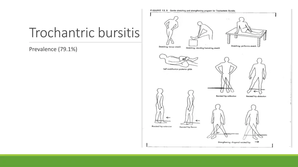 trochantric bursitis