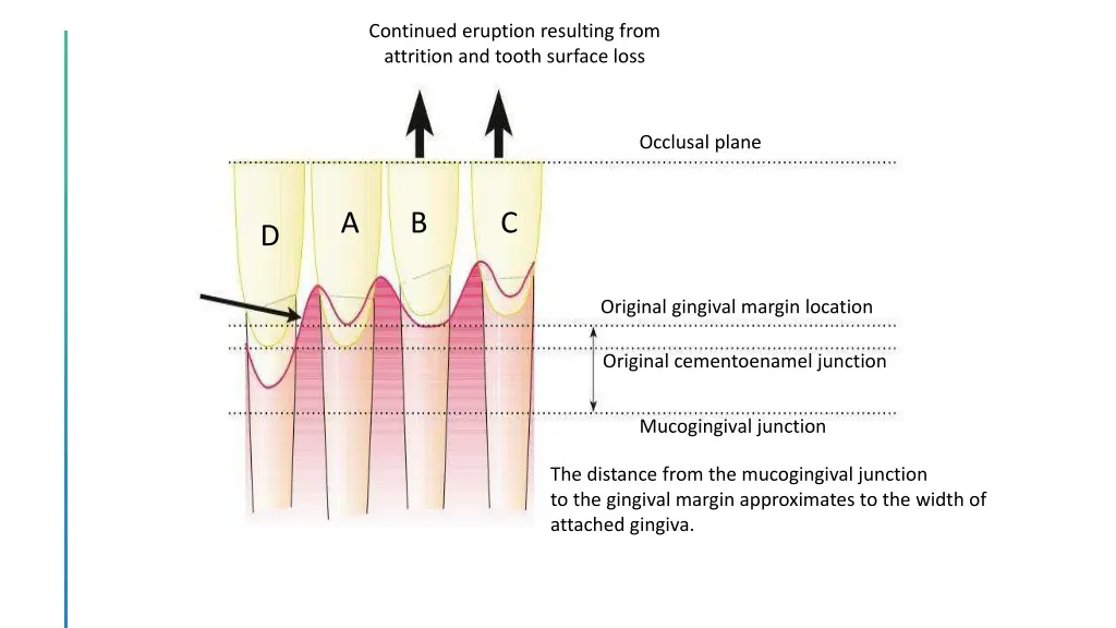 continued eruption resulting from attrition