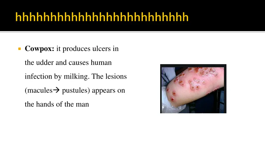 cowpox it produces ulcers in