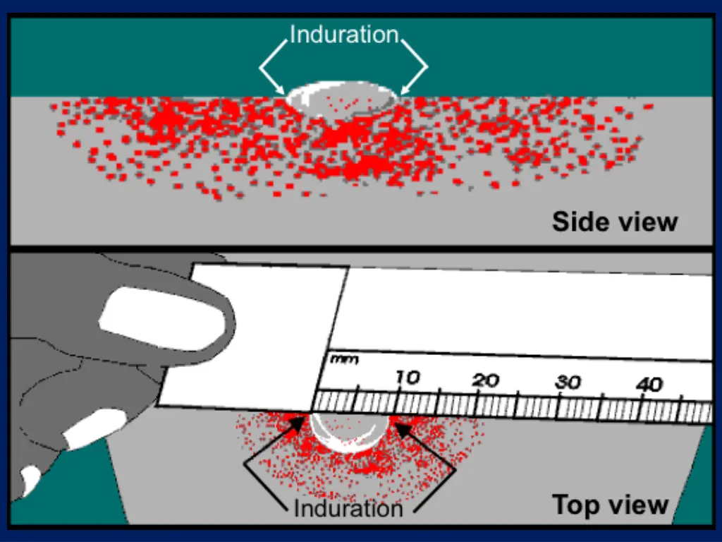 slide27