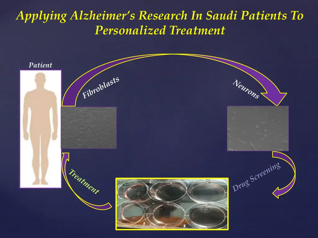 applying alzheimer s research in saudi patients