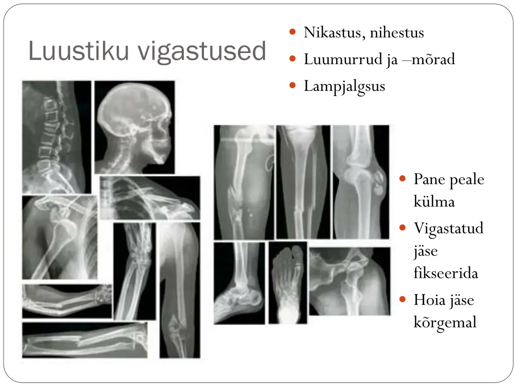 nikastus nihestus luumurrud ja m rad lampjalgsus