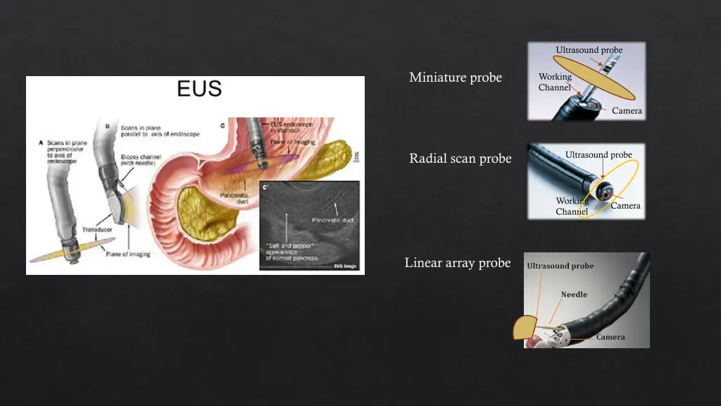 ultrasound probe