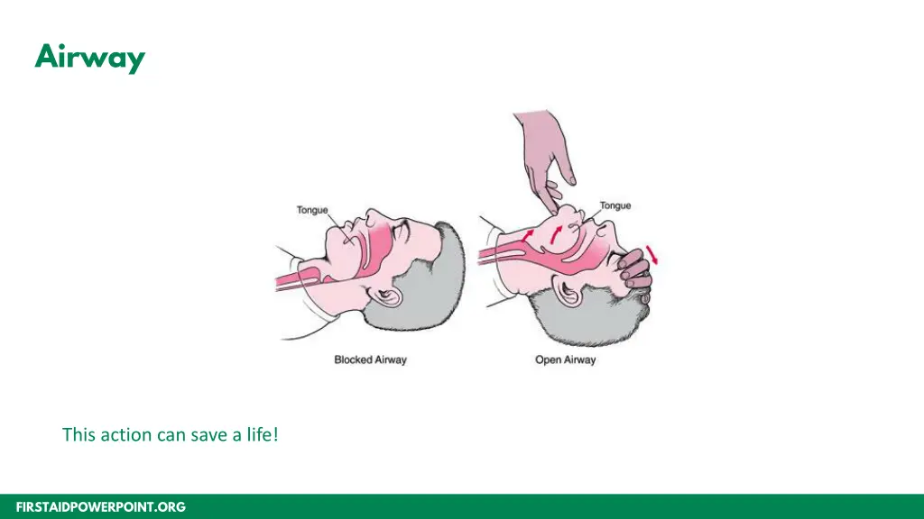 airway 1