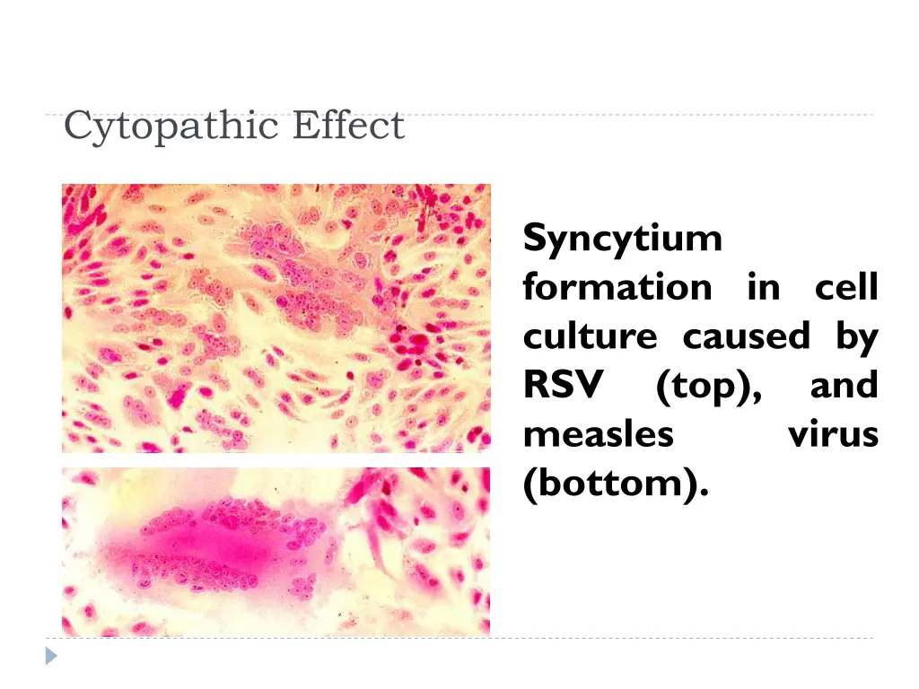 cytopathic effect