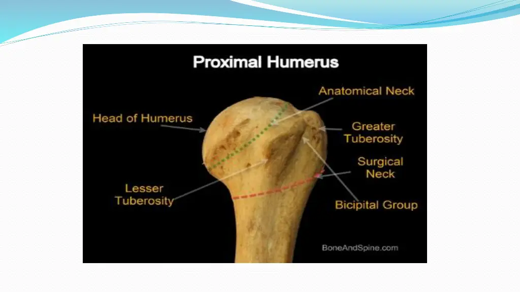 slide12