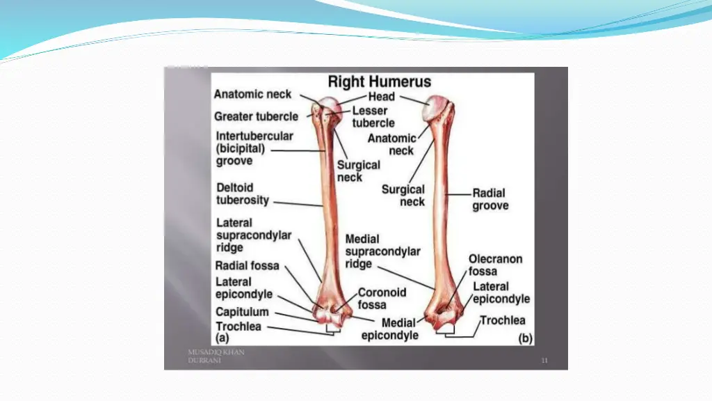 slide13