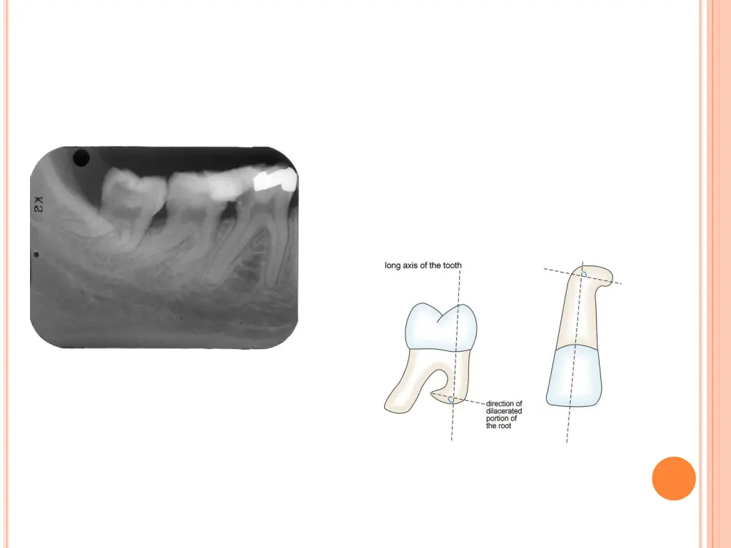slide4