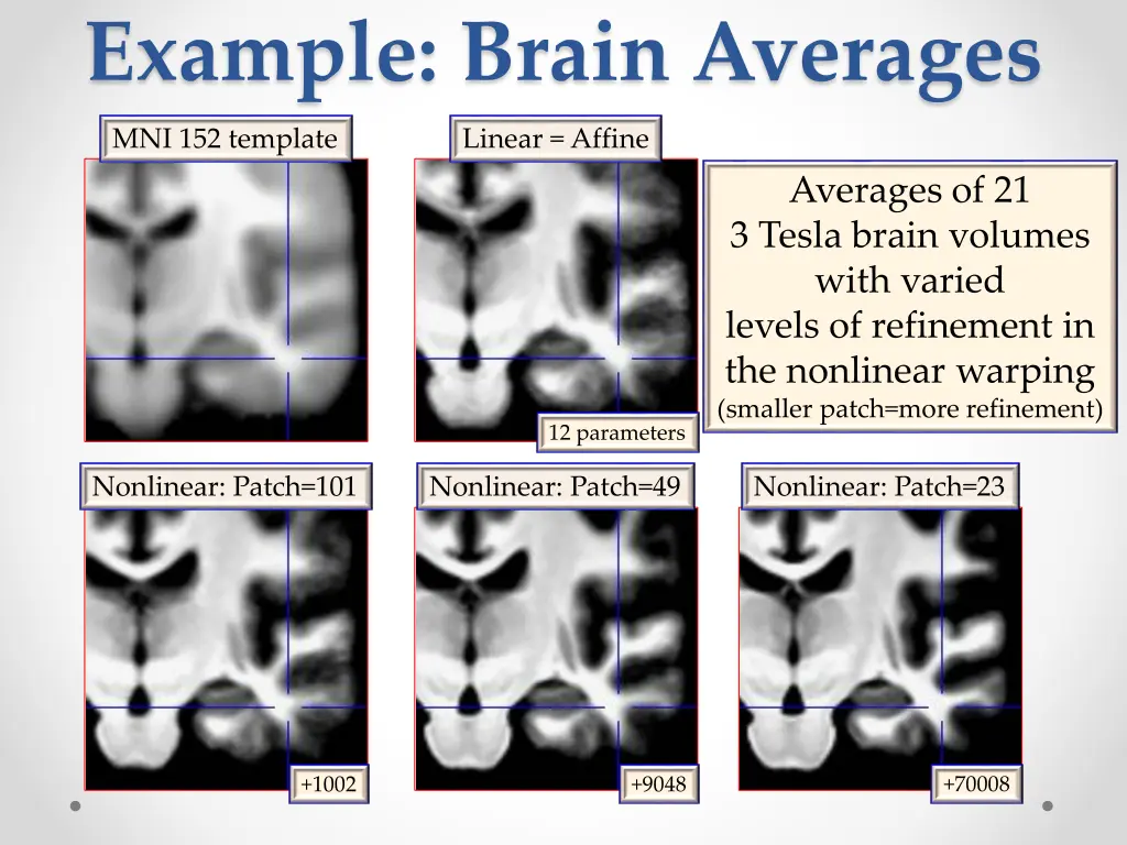 example brain averages