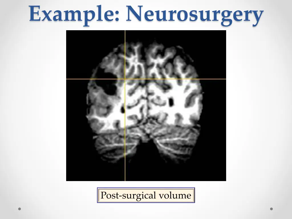 example neurosurgery 1