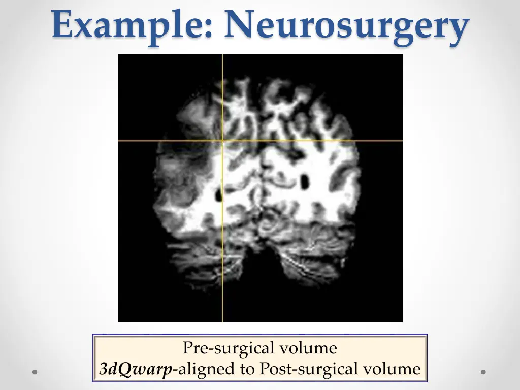 example neurosurgery 2