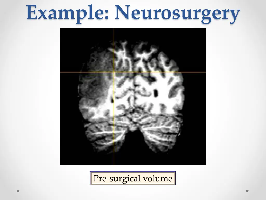 example neurosurgery