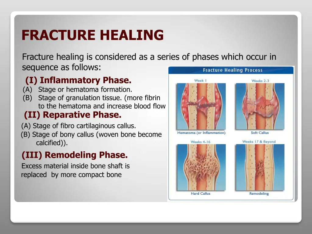 fracture healing