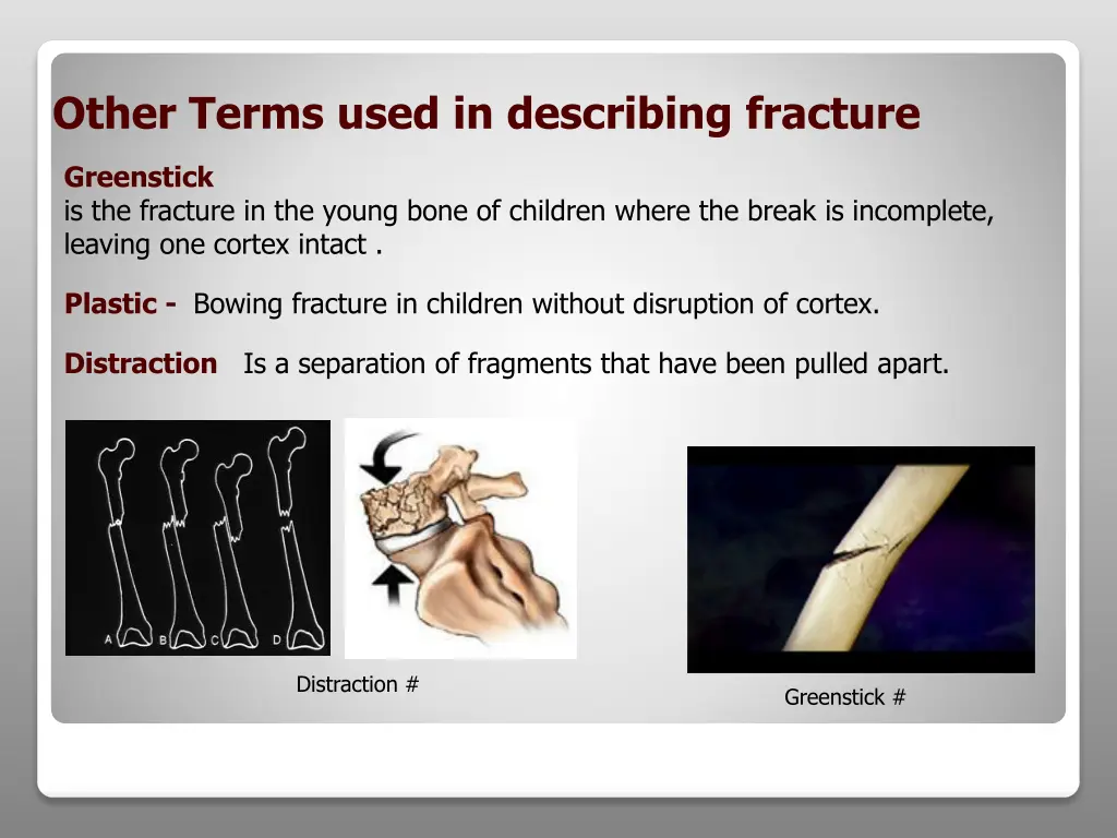other terms used in describing fracture