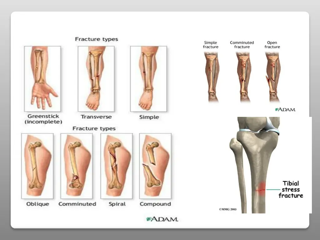 slide12
