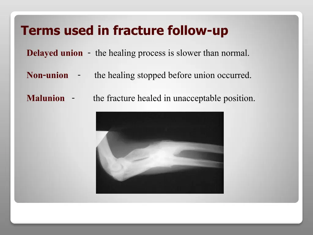 terms used in fracture follow up 1