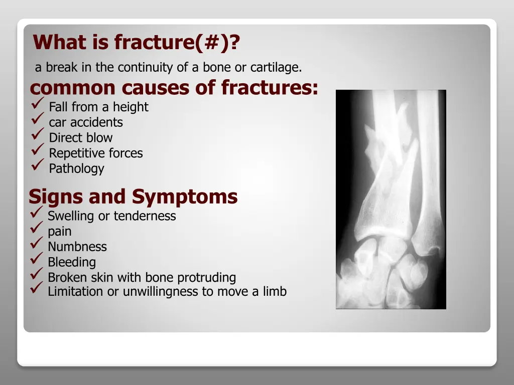 what is fracture a break in the continuity