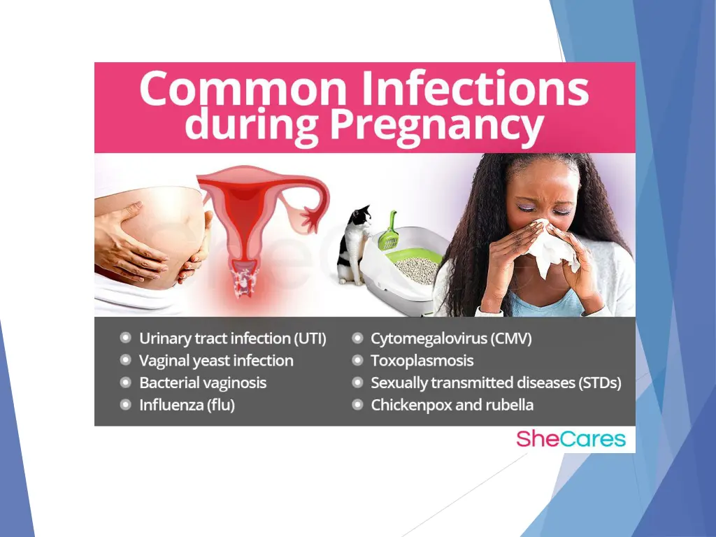 slide3