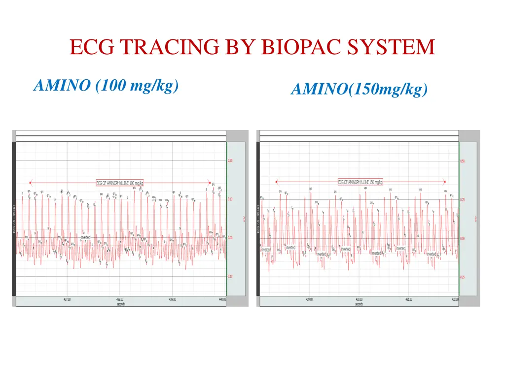 ecg tracing by biopac system 1